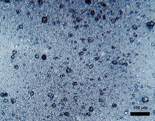 Microplastiche...un problema cui DOBBIAMO trovare una soluzione!!!